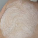 서희세탁소 | 강남등드름 관리 온담에스테틱 강남색소침착 개선