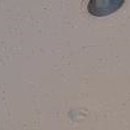 킹남성의원 이미지