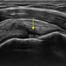 엄지척한의원 이미지