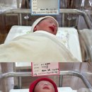 삼성미래산부인과 | 부천삼성미래산부인과 쌍둥이 제왕절개 출산후기