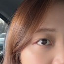 명인외과의원 | 광주 눈 다래끼수술(속다래끼) 리뷰