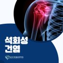 삼성그린마취통증의학과의원 | 밤에 찾아오는 어깨통증 &#39;석회성건염&#39;
