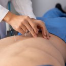卍 ▶…척추관협착증, 약침치료 시행하니 회복 속도 빨랐다 효과도 오래 지속. 이미지