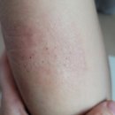 선하사 | 엠디셀 써지실드크림 : 시술 후 예민한 피부 수분 진정 크림