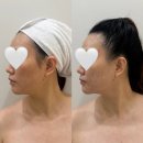 계룡타워 | 착붙 볼륨 리프팅 페이스관리 고운율에서 받은 후기 실력좋고 잘하는 계룡에스테틱 맛집이더라구요.