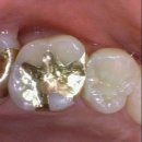 엘치과기공소 이미지