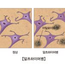 중앙신경과의원 네이버블로그