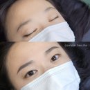 미송피부관리엔왁싱