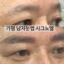 시그노엘 네이버블로그