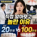 하얀미소치과의원 - 용인시 수지구 현암로 165 | 라미네이트비용 직접 알아보고 놀란 이유｜치아당 20만 원과 100만 원 차이