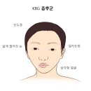 케이비지