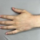 (주)수하나헬스케어 | [전주왁싱] 뷰티포렛왁싱 :: 브라질리언 왁싱 깔끔한 왁싱샵 추천