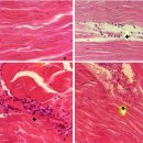 복강주사 IMNV (infectious myonecorsis virus) 인위감염 징거미새우의 복절 근육의 조직학적 변화 이미지