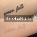거의로 | [강남타투제거] 6회차 솔직후기 ✨ 거의 다 지워진 레터링 타투 변화!