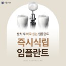 구파발역치과, 발치 즉시 &#39;임플란트&#39; 가능할까요?