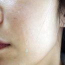 모공수축 피부진정에 터쿠아이즈 아로마에센셜오일