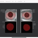 아이뱅크 안경원 이미지