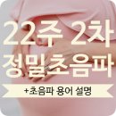 (신)제일병원 | [임신 정보] 22주 1일 / 2차 정밀 초음파 / 초음파 용어 설명 / 동탄 제일 병원 후기