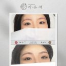 라온채 | 잔흔 커버했더니 진짜 더 이상해졌다는 후기 들으셨다고요? 라온채는 다릅니다.