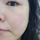 [리뷰] 사하구 하단 당리 피부관리_오브에스테틱 수분관리 후기