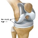 SUIT GYM(수트짐) 이미지