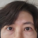 탄생 | 세종 피부과 스킨부스터 에버클 탄생주사 엄마 효도 후기