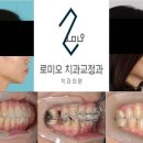 로미오치과교정과치과의원 이미지