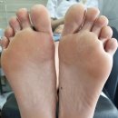 예쁜눈고운발 | 광주발각질제거 퍼석퍼석에서 매끈으로 예쁜눈고운발