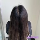 모델헤어라인 | 일산 원장이 직접 해본 두피케어 이야기 (헤어라인 &amp; 가르마 리얼 후기)