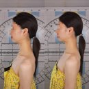 김해농업협동조합 | [김해 장유/미선에스테틱] 장유 비대칭얼굴 개선 JH윤곽 윤곽관리 후기