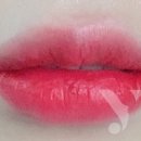 청담윤미인의원 이미지