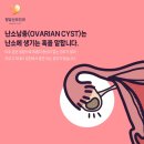 청담산부인과의원 | 난소 자궁내막증 낭종 경화술 수술 후기 회복 기간 강남 학동역 청담산부인과의원