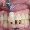 신흥치과기공소 이미지