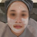 공명한의원 | 천안여드름흉터한의원 새살침 6회차 리젠부스터 내돈내산 후기