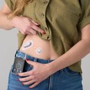 바이오닉스 이미지