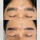 리누에스테틱 이미지