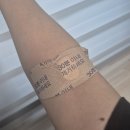 천자로 | 21개 난자채취후 과배란증후군 평촌마리아 복수천자후기