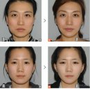 라비앙성형외과의원 이미지