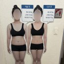 서울/강남 | 강남비만클리닉에서 무릎살빼기 “<b>이오</b>팻주사” 솔직후기