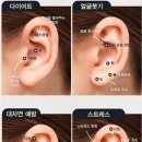 귀건강(이혈테라피) 이미지