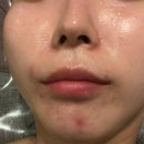 압구정피부관리 올빚뷰티라운지 스킨케어 후기