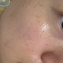 화중로104번길 | 화정역피부관리 오늘에스테틱 | 모공케어 받고 피부결이 달라져서 만족한 솔직후기