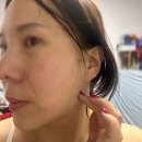 위드팜새동안약국 | 내돈내산 토닝후 건조해진 피부에 단비같았던 리쥬치올 PDRN 퍼펙트 앰플& 크림 후기