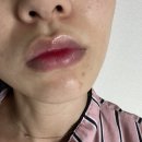 페타씨에스티 | 에슬 스킨 플랫 패치 | 피부요철케어 꿀템