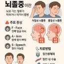 뇌졸중의 예방과 치료 이미지