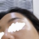 비우고채움 | [동탄에스테틱] 반송동 피부관리 ‘채움피부연구소’ 쥬베륨 관리로 속광 찾은 후기!