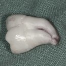 휴아치과의원 이미지