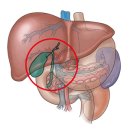 선천성 담관 폐쇄증[Congenital Atresia of Bile Ducts] 소아청소년질환, 소화기질환 이미지