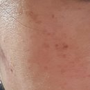 바른약국 | 도미나 기미크림 사용후기 약국 완판 기미크림 한달 후기