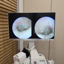 스타키보청기 춘천난청센터 이미지